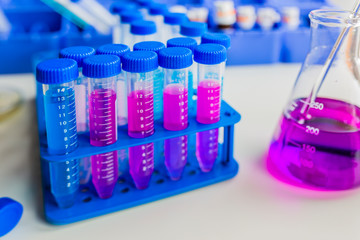 Medical diagnostic laboratory. Samples of the material for testing and reagent in a test flask with...