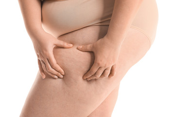 Overweight woman with cellulite problem on white background, closeup