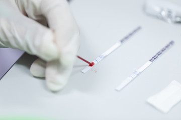 Study of Hepatitis-B Detection in laboratories.