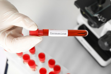 Scientist holding test tube with blood sample and label CORONA VIRUS in laboratory, above view