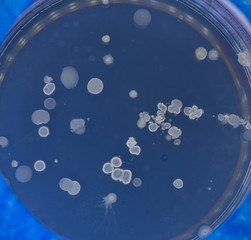 Tests for skin fungal diseases. Samples of fungus causing skin diseases grown in a petri dish