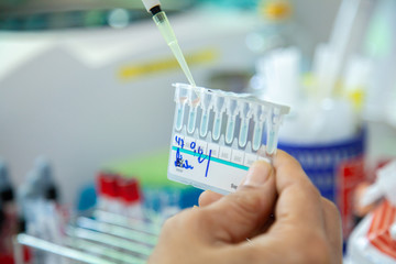 Crossmatching, Compatibility testing between patient blood and donor blood