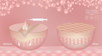 Hyaluronic acid before and after skin solutions ad, pink collagen serum drop with cosmetic advertising background ready to use, illustration vector.