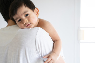 The parent is hugging a sickness asian little baby boy from viral infection skin rash, concept of...