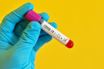 Obraz premium Blood sample tube positive with COVID-19 or novel coronavirus 2019 found in Wuhan, China