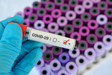 Obraz premium Blood sample tube positive with COVID-19 or novel coronavirus 2019 found in Wuhan, China