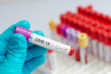 Fototapeta premium Blood sample tube positive with COVID-19 or novel coronavirus 2019 found in Wuhan, China