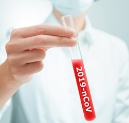 Scientist holding a test tube with Coronavirus 2019-nCoV blood sample.