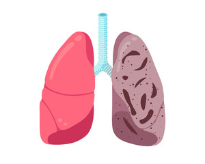 Sick unhealthy lungs tuberculosis infection disease. Human respiratory system internal organ tubercle bacillus infected or pneumonia struck. Medical anatomy inflammation damage vector illusrtation