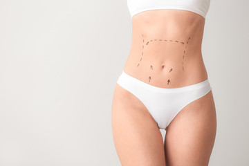 Young woman with marks on her belly against light background. Concept of plastic surgery