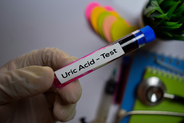 Obraz premium Uric Acid - Test with blood sample. Top view isolated on office desk. Healthcare/Medical concept