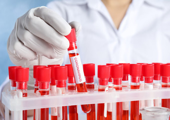 Scientist taking test tube with blood sample and label CORONA VIRUS from rack in laboratory, closeup