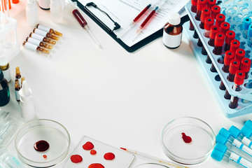 Close-up of test tubes arranged on a table in medical laboratory