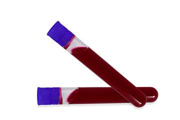 Blood test tubes in laboratory isolated on white