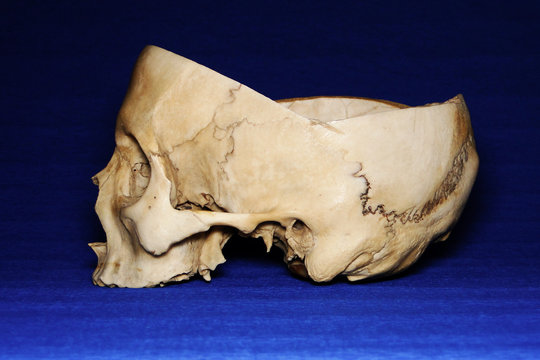 Cut real human skull on blue background, side view