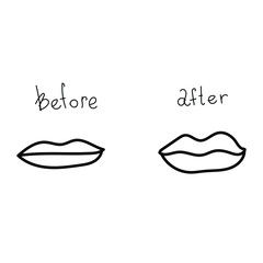 Before and after transformation process, lip plumping progress. Vector stock illustration in doodle style.