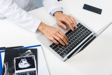 cropped view of professional doctor with ultrasound scans working with laptop and smartphone