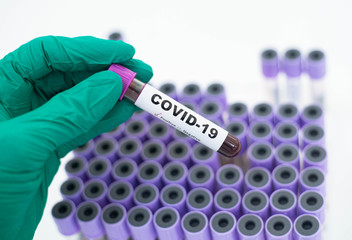 laboratory technician hand hold on blood sample tube for corona virus test , COVID 19 test  