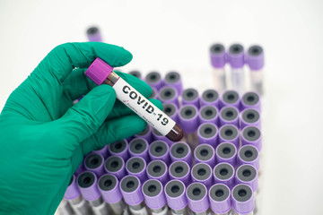 Fototapeta premium laboratory technician hand hold on blood sample tube for corona virus test , COVID 19 test 