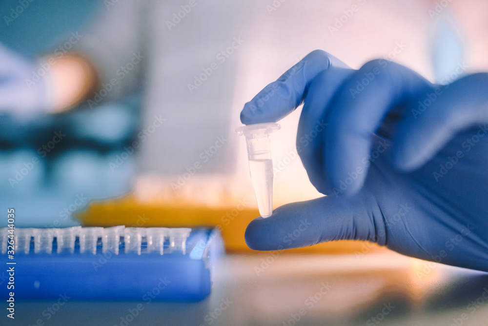 Wall mural laboratory tests for viral infections. coronavirus ncov, mers-cov respiratory syndrome coronavirus. 