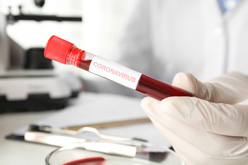 Scientist holding test tube with blood sample and label CORONA VIRUS in laboratory, closeup