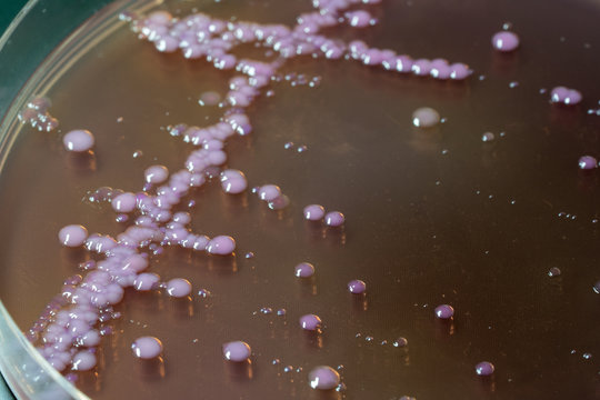 bacterial colonies   on  agar   medium petri dish plate plate on MacConkey agar