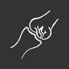 Joint fracture chalk white icon on black background. Injured limb. Broken bone. Accident. Healthcare. Trauma treatment. Medical condition. Damaged body part. Isolated vector chalkboard illustration