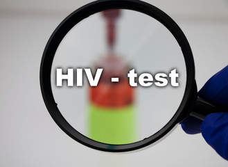 A blood sample for a test for HIV (human immunodeficiency virus). The doctor’s hand holds a...
