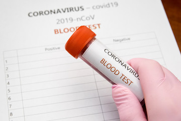 Coronavirus, covid19 - blood test. Test krwi - koronawirus. - obrazy, fototapety, plakaty