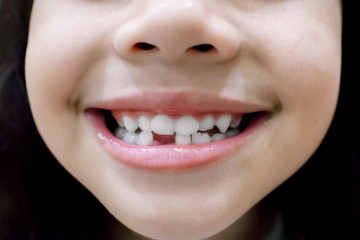 little girl smile losing his first tooth 