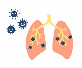 肺炎　肺結核