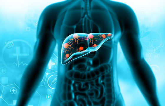 Virus attack on human liver. 3d illustration.