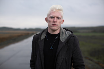 Albino guy stands on a country road