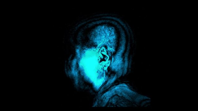 Brain computer tomography result visualization. Vertical slides of human head screening