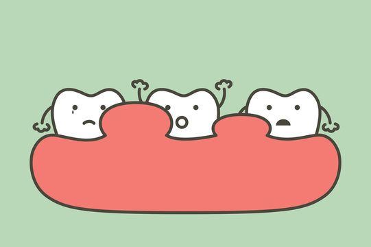 unhealthy teeth because gingivitis or gum disease with abscess, gum is swollen - dental cartoon vector flat style