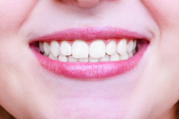 Young woman with healthy teeth