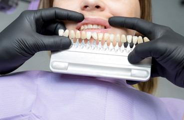 Closeup of a girl with beautiful smile at the dentist. Dental