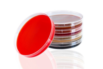 Petri dishes with different growth medium or culture medium, a solid, liquid or semi-solid designed...