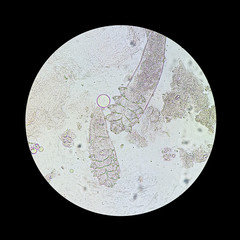 Demodex mite from a microscope view. The parasite causing a skin disease -Demodecosis.