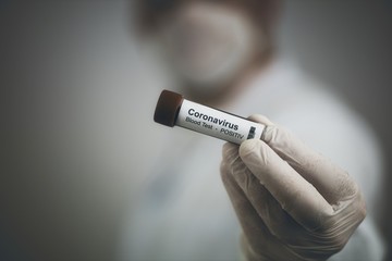 2019-nCoV Coronavirus. The doctor holds a positiv blood sample for Coronavirus testing. Epidemic...