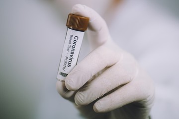 2019-nCoV Corona virus. doctor holds a positiv blood sample for Coronavirus testing. Epidemic...