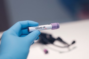 Naklejka premium COVID-19 laboratory blood test coronavirus background concept