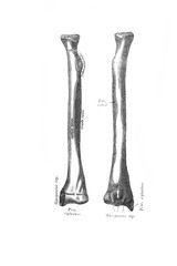 Right radial bone, front, back in the old book the Anatomie of a Human, by M.P. Vishnevskiy, 1890, Moscow