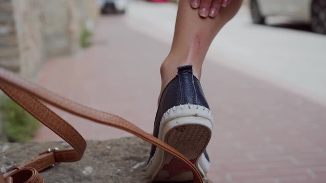 Woman scratched her leg on vacation. Girl in shoes smears healing cream on leg