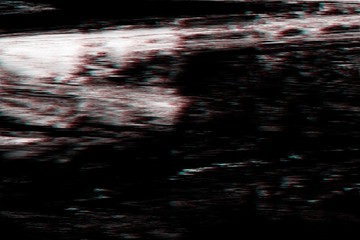 Glitch no signal background pixel noise,  damaged pattern.