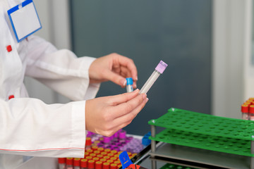 Doctor holds a blood sample tubes in his hand in the lab.