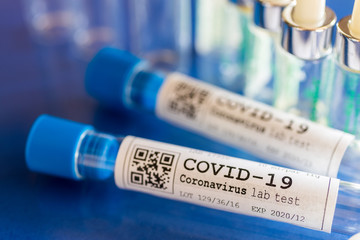 dangerous coronavirus Covid-19 virus in a laboratory - infection of 2019-nCoV virus.  Global...