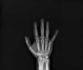 Naklejka premium x- ray of the wrist joint