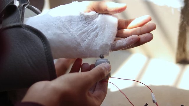 Cutting hand plastered cast with a self made electronic motor at home