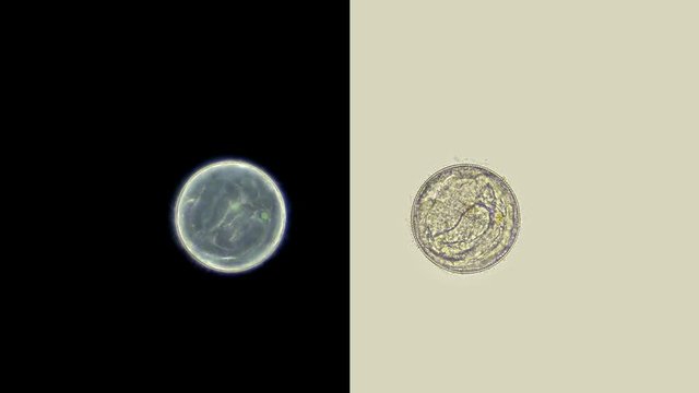 eggs with developing Ascidia ascidia larvae (Tunicata) under a microscope, found in all seas and oceans, live on rocky areas of the seabed, class chordata